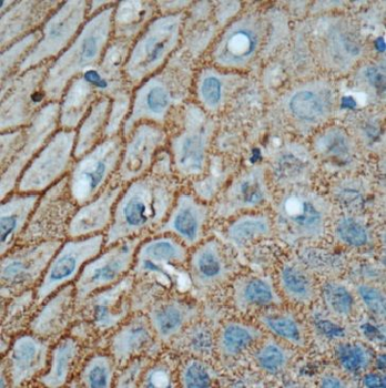 GJB3 Antibody