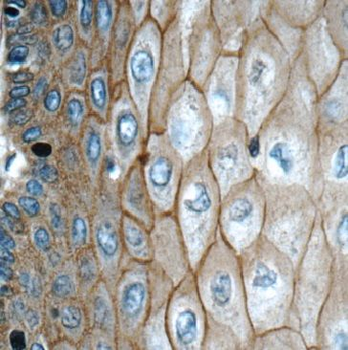 GJB6 Rabbit Polyclonal Antibody