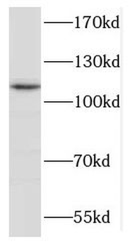 GLDC Rabbit Polyclonal Antibody