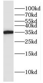GLOD4 Antibody
