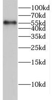 GLRB Antibody
