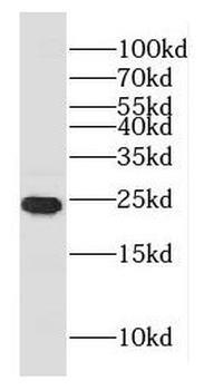 GLTP Rabbit Polyclonal Antibody