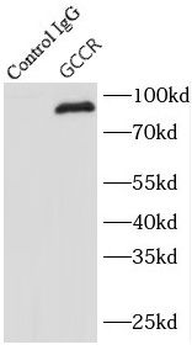NR3C1 Rabbit Polyclonal Antibody