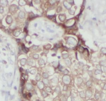 SLC2A1 Rabbit Polyclonal Antibody