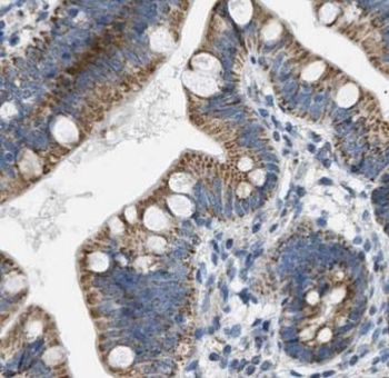 SLC2A2 Antibody
