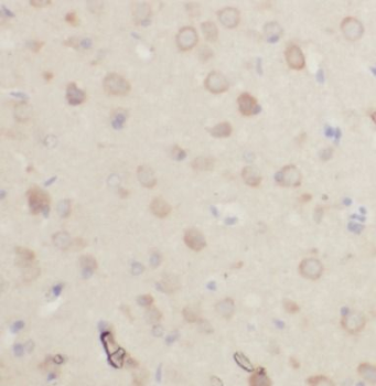 SLC2A3 Antibody