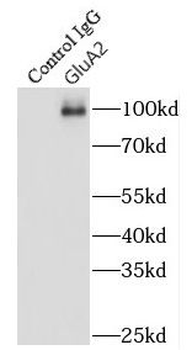 GRIA2 Antibody