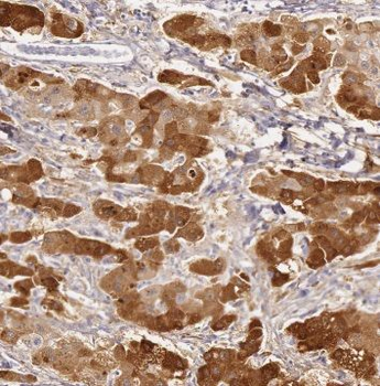 GLUL Antibody