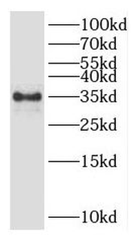 GLYAT Antibody