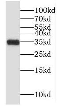 GLYATL1 Antibody