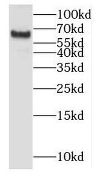 GK Rabbit Polyclonal Antibody