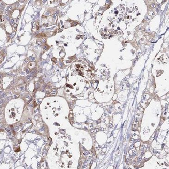 GLYCTK Antibody
