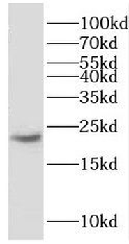 GM2A Antibody
