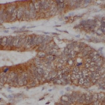 GM2A Antibody