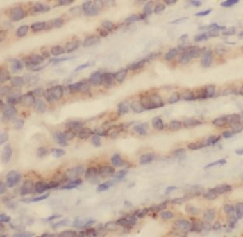 CSF2 Antibody