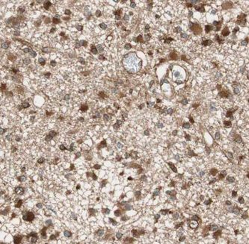 GNAI1 Antibody