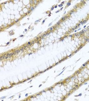 GNAI3 Antibody