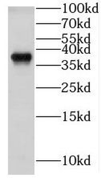 GNB1 Antibody