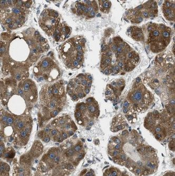 GNB3 Antibody