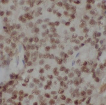 GNL2 Antibody