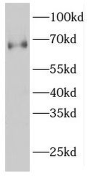GNPAT Antibody