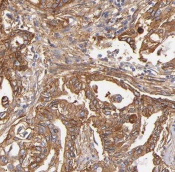 GNPDA1 Antibody