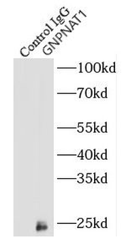 GNPNAT1 Antibody