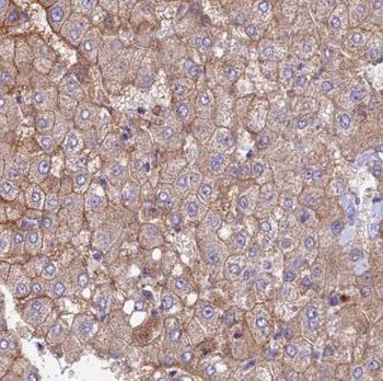GNPNAT1 Antibody