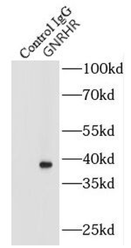 GNRHR Antibody