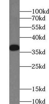 GNRHR Antibody