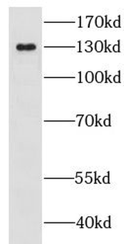 GOLGA2 Rabbit Polyclonal Antibody