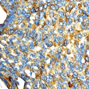 GOLGA2 Antibody