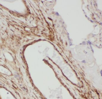 GOLPH3 Antibody