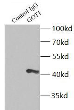 GOT1 Rabbit Polyclonal Antibody