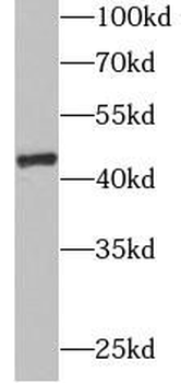 GOT1 Rabbit Polyclonal Antibody