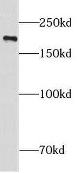 NUP210 Antibody