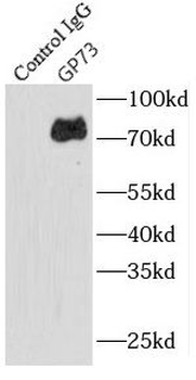 GOLM1 Antibody