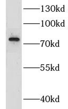 GOLM1 Antibody