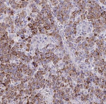 GOLM1 Antibody