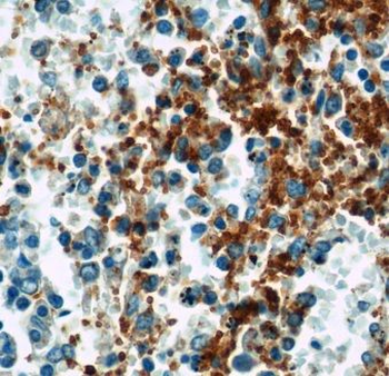 GP9 Antibody