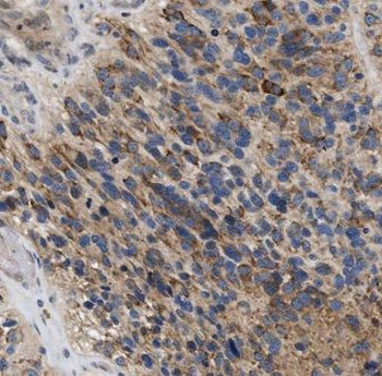 GPAA1 Antibody