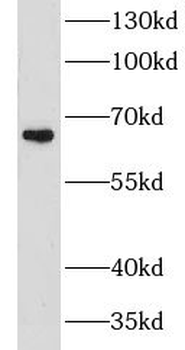 GPATCH2 Antibody