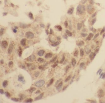 GPATCH2 Antibody