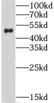 GPATCH4 Rabbit Polyclonal Antibody