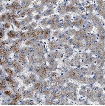 GPATCH4 Rabbit Polyclonal Antibody