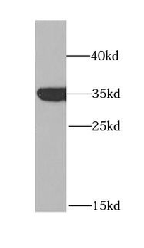 GPD1 Antibody