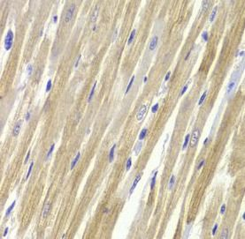 GPD1 Antibody