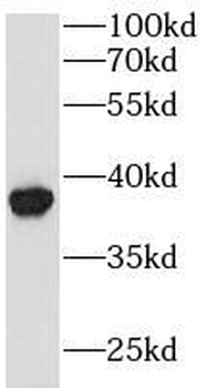 GPD1L Antibody