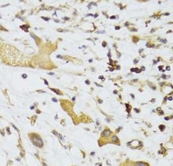 GPD2 Antibody