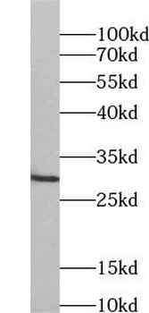 GPM6A Antibody